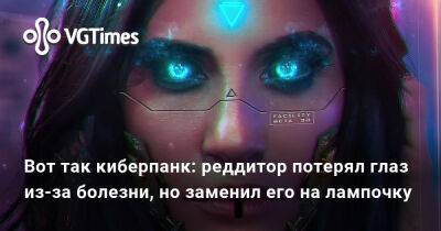 Вот так киберпанк: реддитор потерял глаз из-за болезни, но заменил его на лампочку - vgtimes.ru