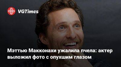 Мэттью Макконахи - Мэттью Макконахи ужалила пчела: актер выложил фото с опухшим глазом - vgtimes.ru