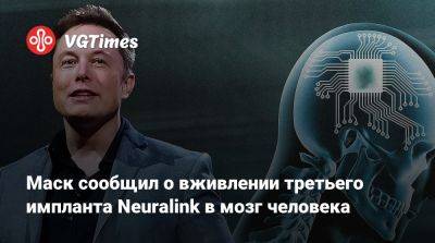 Илон Маск - Маск сообщил о вживлении третьего импланта Neuralink в мозг человека - vgtimes.ru