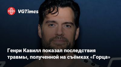 Дэйв Батиста - Генри Кавилл - Стахелски (Chad Stahelski) - Генри Кавилл показал последствия травмы, полученной на съёмках «Горца» - vgtimes.ru - Англия - Чад
