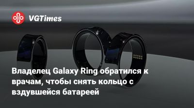 Владелец Galaxy Ring обратился к врачам, чтобы снять кольцо с вздувшейся батареей - vgtimes.ru